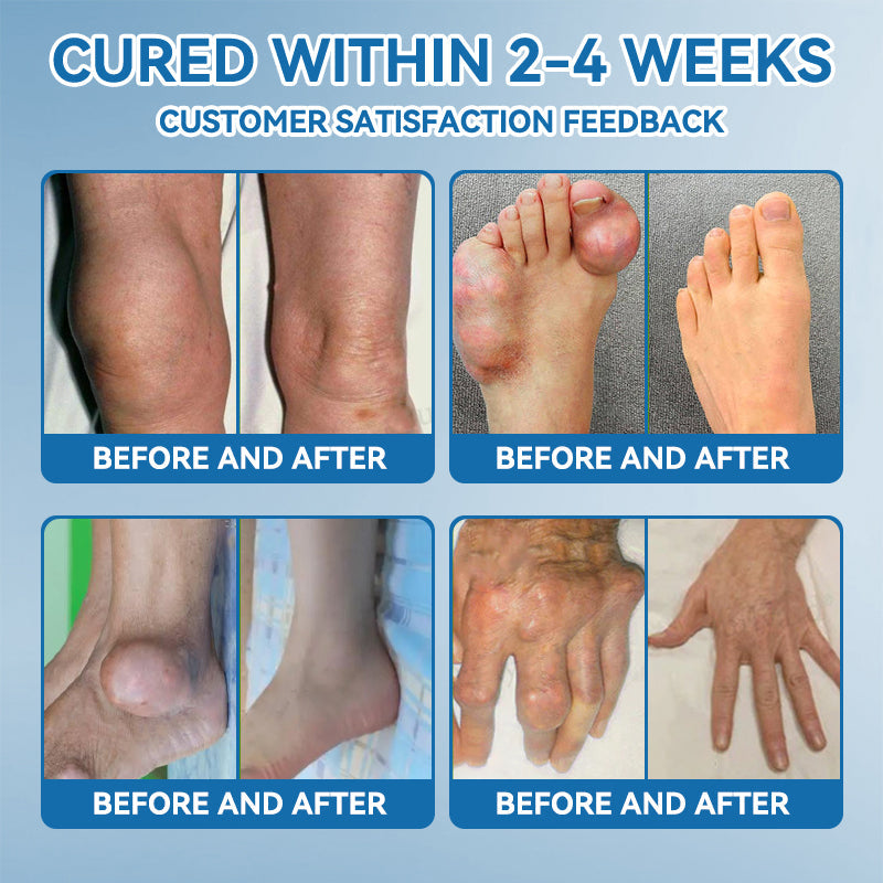 🇬🇧𝐟𝐥𝐲𝐬𝐦𝐮𝐬® 𝐁𝐏𝐂-𝟏𝟓𝟕 𝐉𝐨𝐢𝐧𝐭 𝐇𝐞𝐚𝐥𝐢𝐧𝐠 𝐂𝐫𝐞𝐚𝐦🦴Treats Arthritis, Neuropathy, Rheumatism, Sports Injuries & More🇬🇧🏆