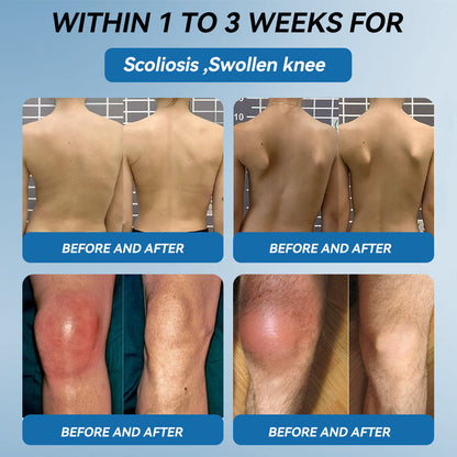 🇬🇧𝐟𝐥𝐲𝐬𝐦𝐮𝐬® 𝐁𝐏𝐂-𝟏𝟓𝟕 𝐉𝐨𝐢𝐧𝐭 𝐇𝐞𝐚𝐥𝐢𝐧𝐠 𝐂𝐫𝐞𝐚𝐦🦴Treats Arthritis, Neuropathy, Rheumatism, Sports Injuries & More🇬🇧🏆